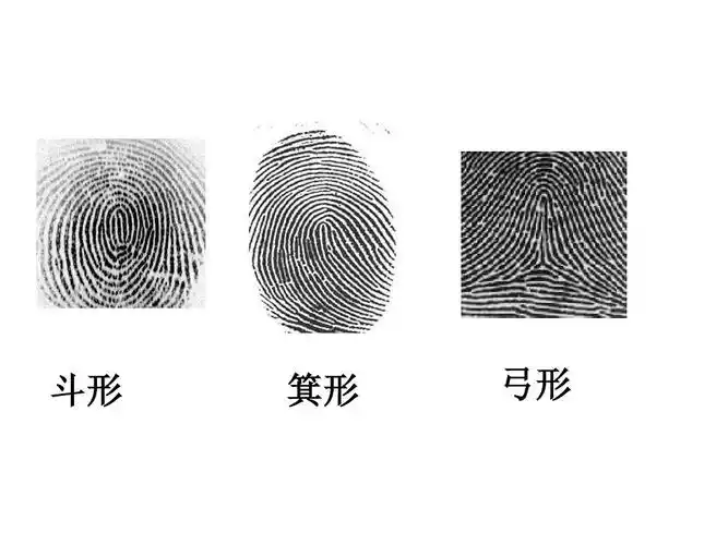 斗形 箕形 弓形