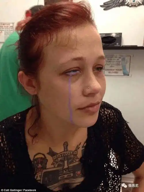 澳美女模特做眼球纹身后失明眼睛发炎竟流出紫色泪水