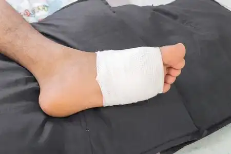 男性包皮用绷带包扎他脚伤照片