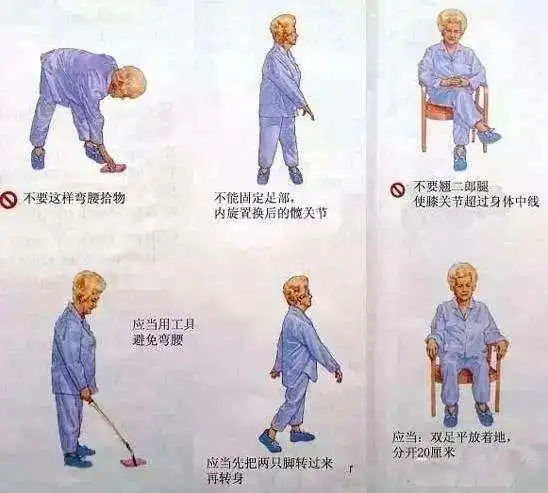 康复指导髋关节置换手术后不同时期康复锻炼要点