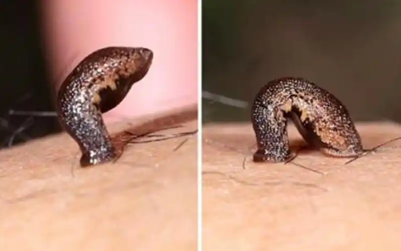 有朋友是大夫,他说,蚂蝗是一种吸血软体动物,以吸食人血或体液为主,吸