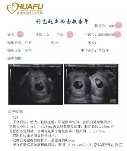 很多孕妈妈在早期产检的时候会被要求做个b超检查,有人会问:怀孕了查