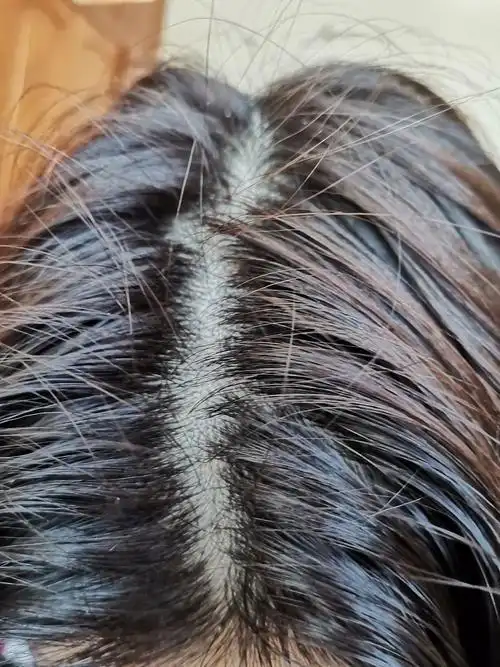 有没有人一个星期不洗头?上图来看看? - 知乎