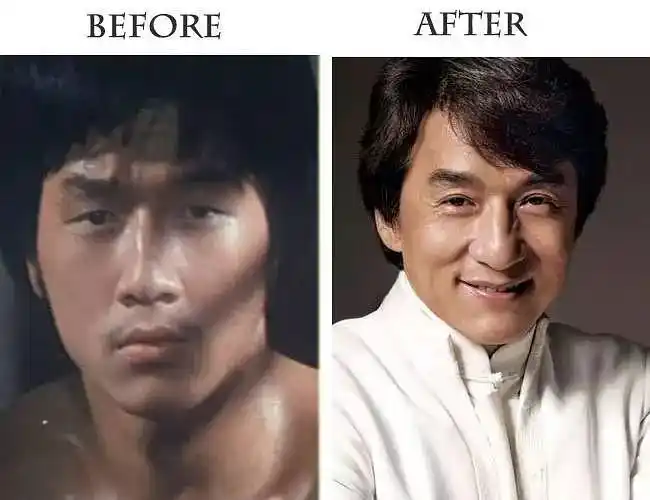 双眼皮对外貌的改变有多大?