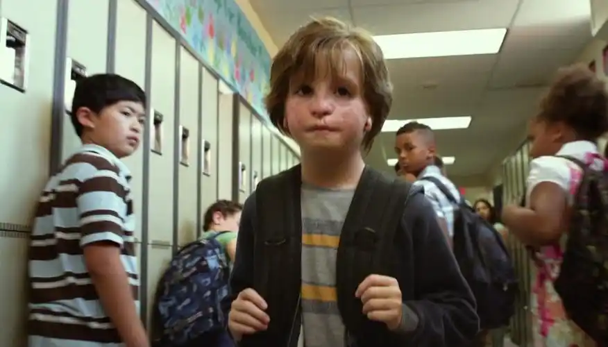 这个奇丑无比的小男孩,影响了6000万父母