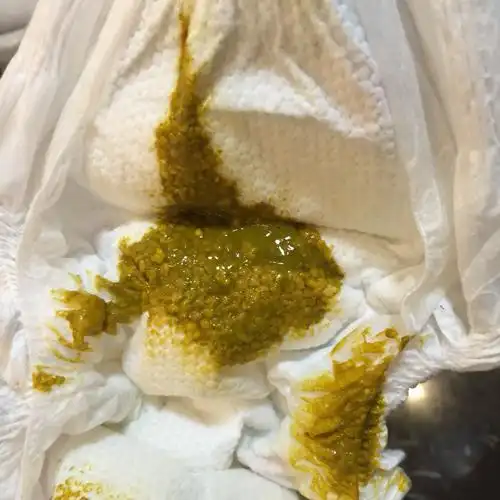 三月半宝宝,一到两天一次大便,是饥饿性便吗