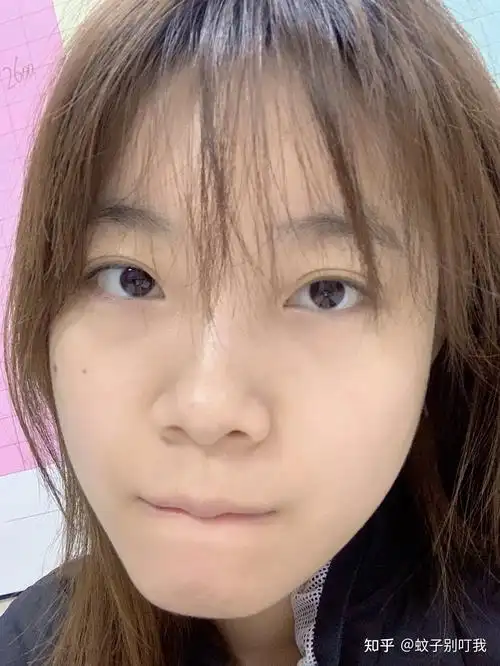 22岁普通女大学生皮肤暗黄没有光泽怎么短时间内提亮肤色美白呢