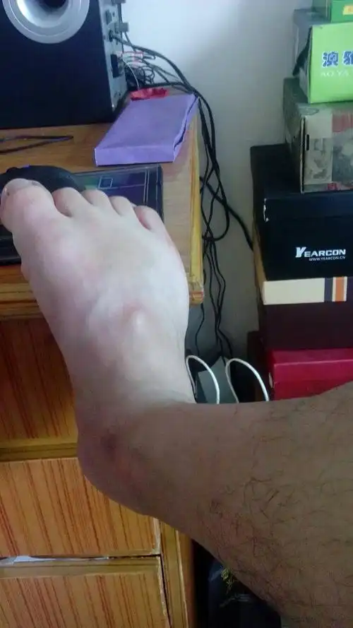 病情分析: 你好,看你说的这个症状,那是否有长了脂肪瘤或是纤维瘤方面