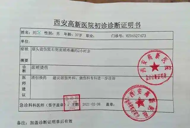 陕西一男子聚餐时被同事用烟头烫伤脸颊!