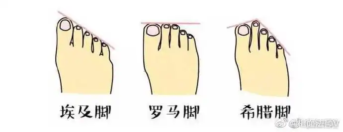 命,看脚型就知道 1 埃及脚脚型十分普遍,大拇指最长,其他脚趾依次递减