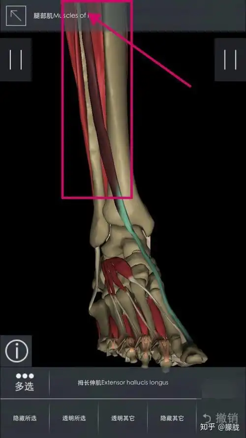 脚背(拇长伸肌)疼是什么原因,怎么办?