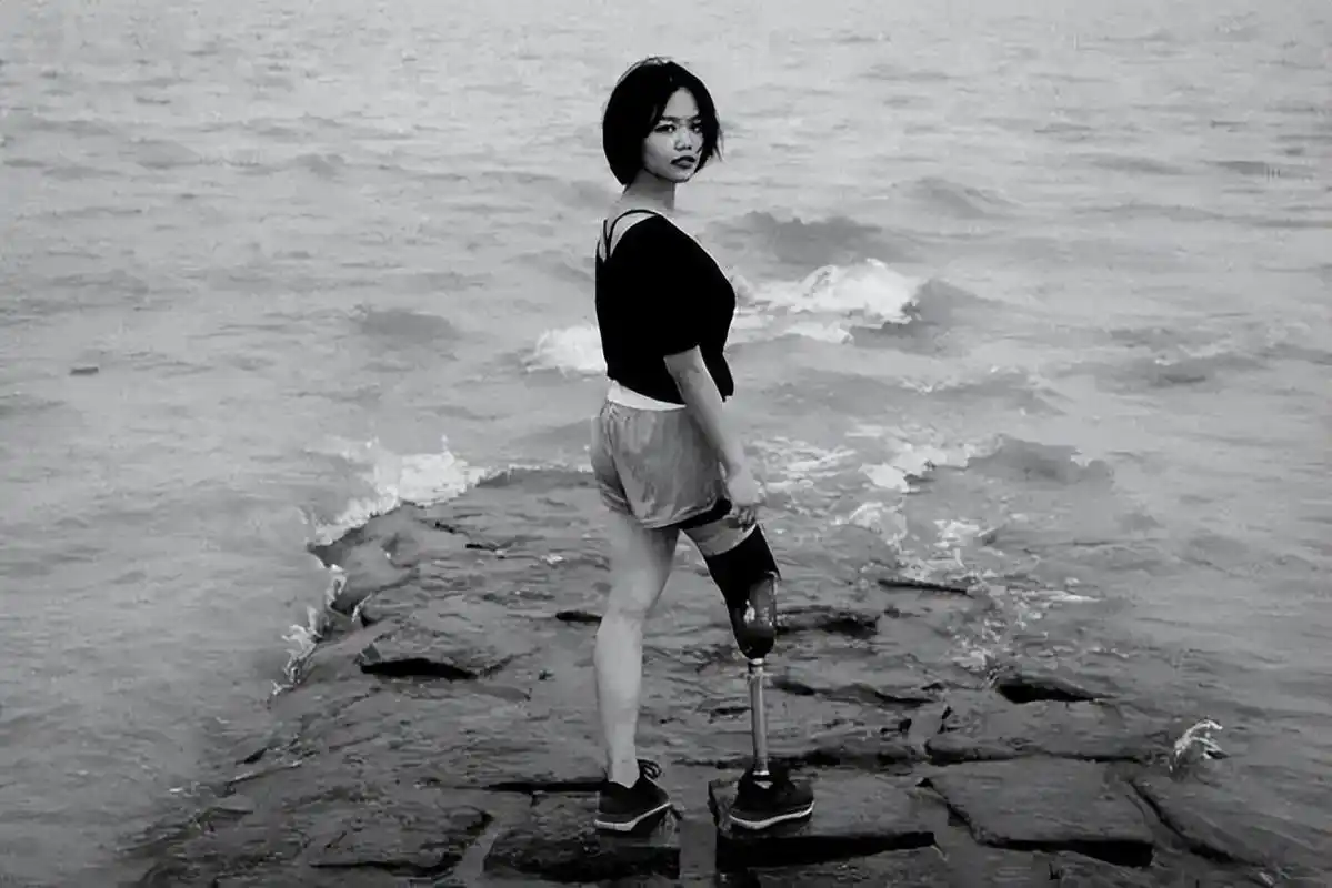 "不是活给你们看!"90后独腿女孩穿短裙,露假肢,为隐形人发声