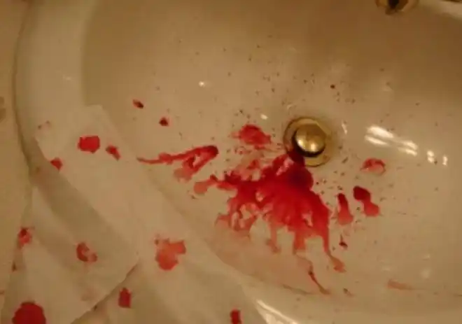 一顿大酒后,小伙呕血不止,喝酒小心3种病,记住酒后:三不做