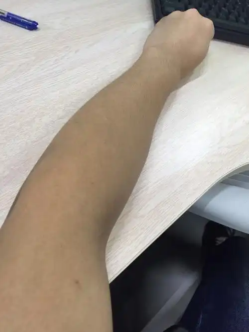 受伤前三个月,前后拍了四个片左右,关节缝隙和位置都很正常,医生说