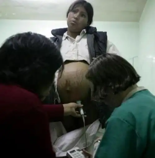 其实,生孩子不是一件轻松的事,反而是充满了诸多困难的.