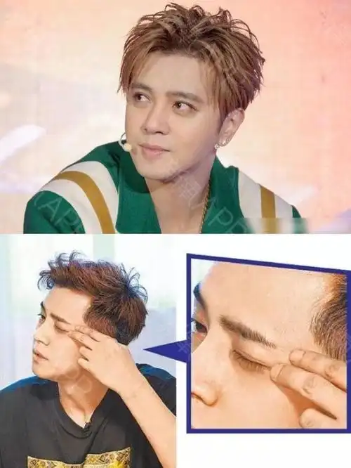 罗志祥这些年就只do了双眼皮?