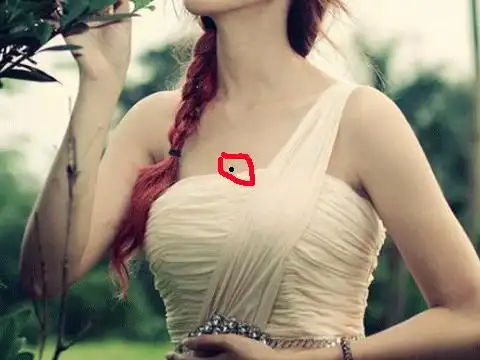 身上最常见的9大幸运痣,你有几颗?