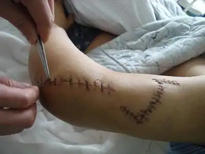 江西律师家门口惨遭砍杀遍体鳞伤