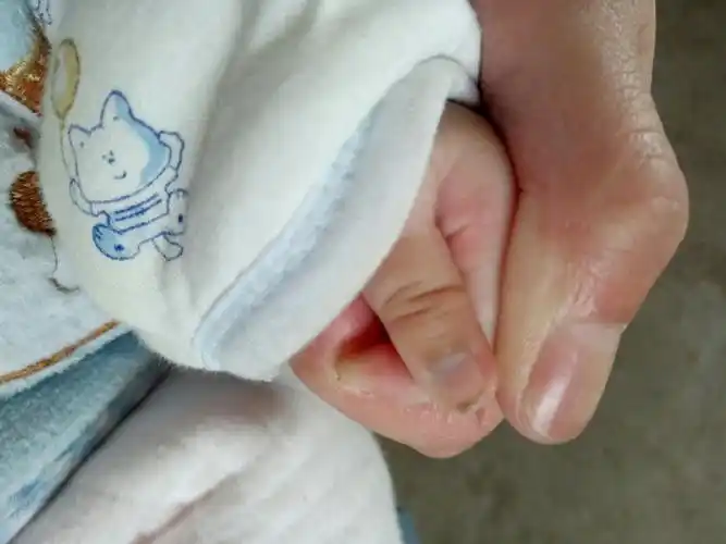 手指甲发紫,可能与天气变凉或血管供血情况有关就目前的天气而言,不