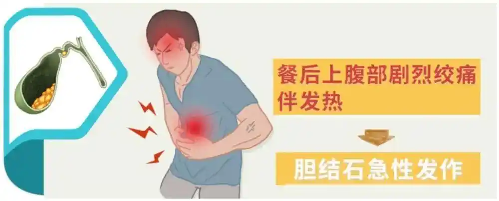 胆囊结石患者一定要警惕这些症状!这说明你需要马上就医!
