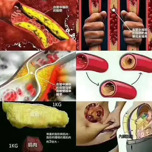 人体脂肪的危害_内脏脂肪_医疗健康_医疗健康其他