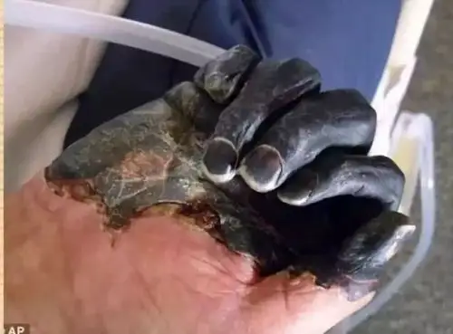 黑死病与文艺复兴 | 协和八