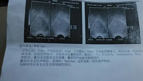 心情无比激动!相隔两周b超对比图