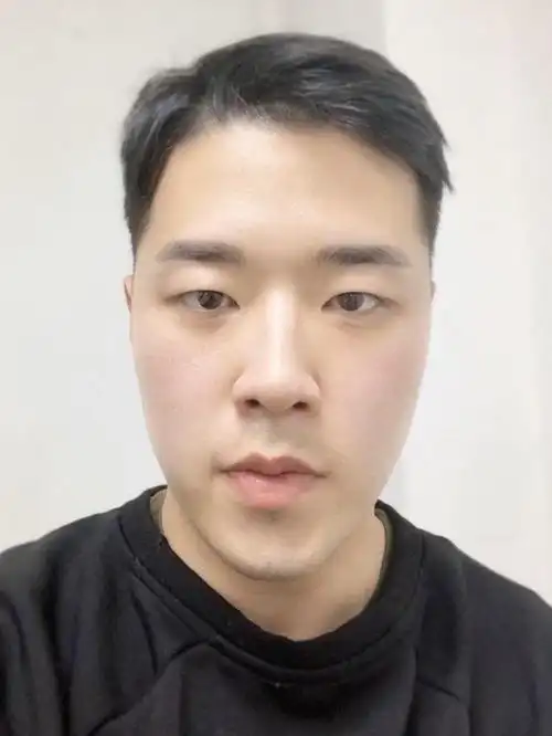 男生案例来了!全脸综合打造2个月反馈