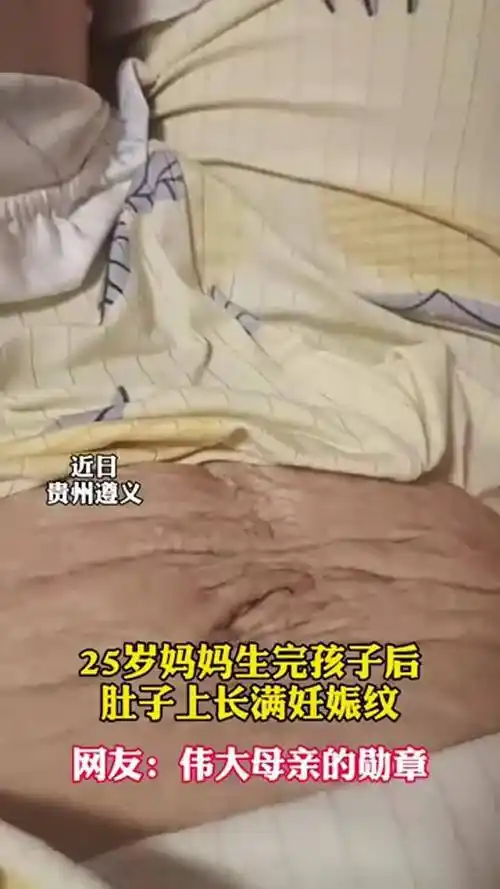 生完孩子肚子有肉的简单介绍