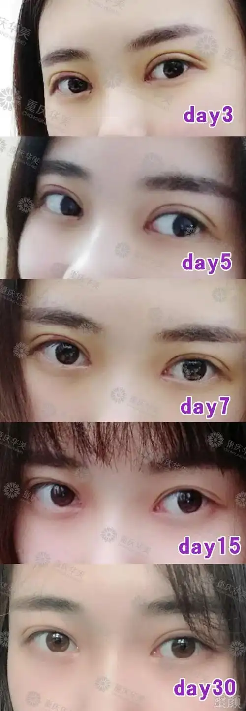 眼睛短小,眼距宽,你与电眼女神只差一个开眼角