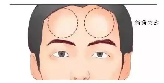 面相额头凹陷看相图解(面相额头有疤痕怎么说)-7080网