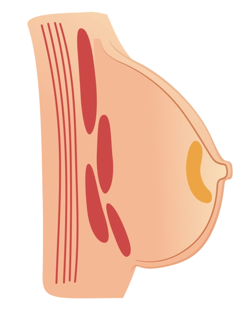 明明断奶了怎么还能挤出水?