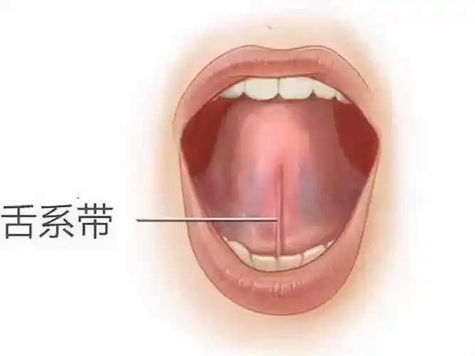 孩子舌系带短会影响他的说话吗?__凤凰网