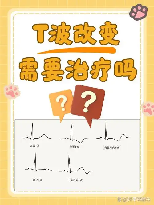 t波改变需要治疗吗?