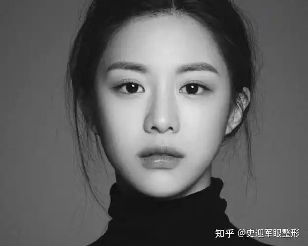 有一种双眼皮叫韩国女星的双眼皮