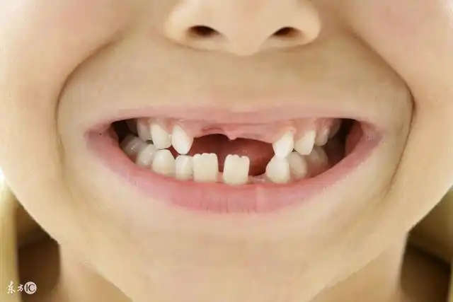 妈妈说换牙的时候舔牙牙齿会长歪真的吗