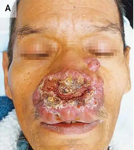 医学资讯_大夫e站