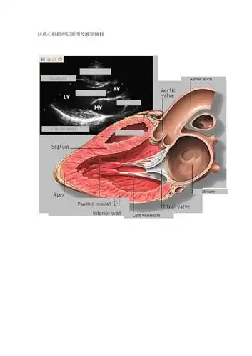【2019年整理】经典心脏超声切面图及解剖解释(20210430104612)