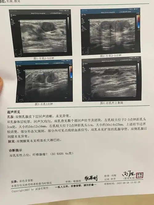 乳腺纤维瘤从3类变4a要不要手术