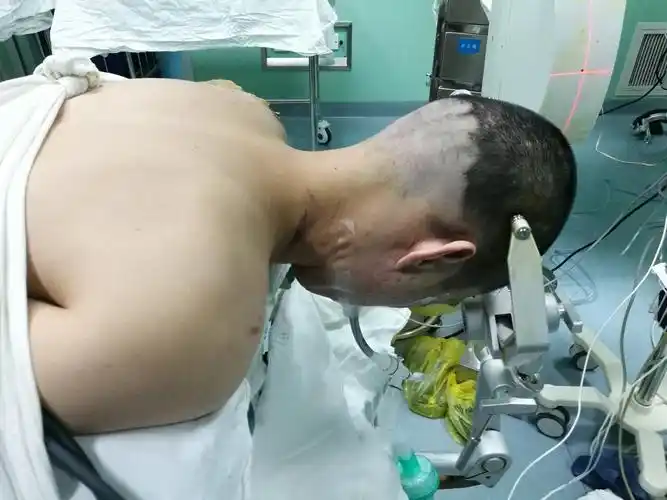 又一例高位颈椎手术成功 - 好大夫在线