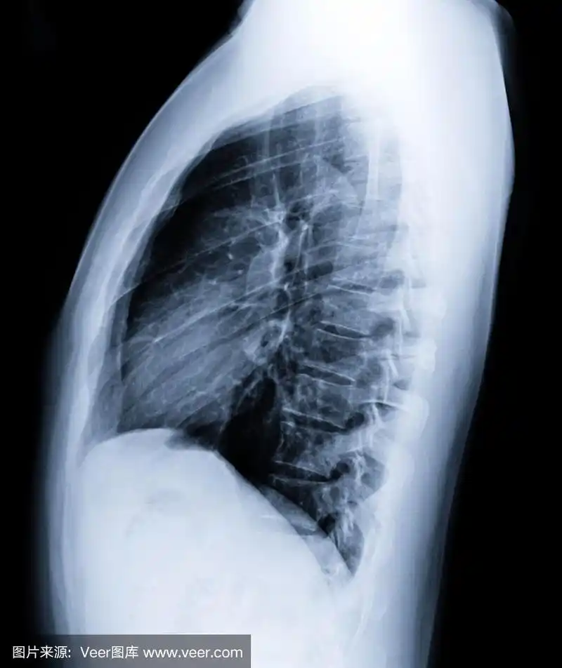 胸部x光片或人体侧面x光片,对检测心脏病和肺病有充分的启发.