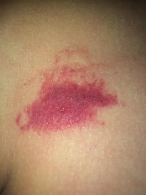 老公肩上的是吻痕吗?