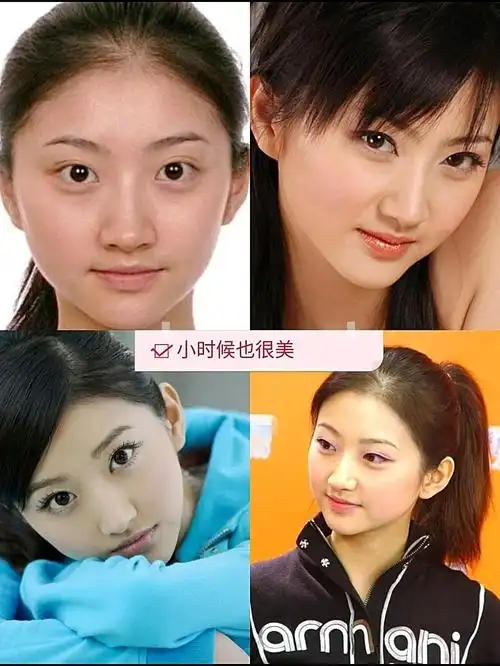 邀先来盘点一下景甜_圈子-新氧美容整形