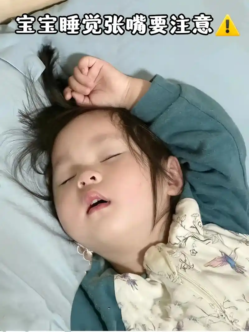 宝宝睡觉张嘴要注意!爸妈敲重点!#呼吸矫正贴 妈妈们自查一 - 抖音