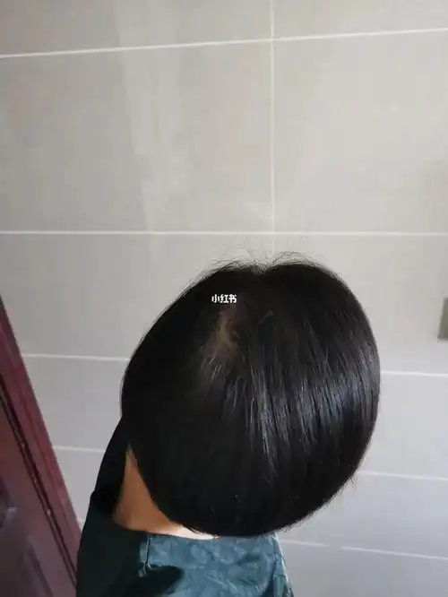 即使你俯视我的头顶,我也不自卑了