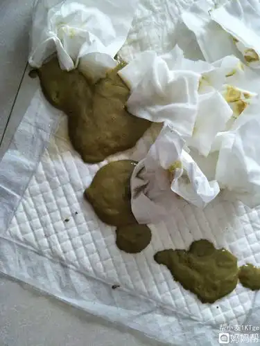 *猜你喜欢*  宝宝两个多月了,黄疸老是反复,医生说大便颜色像陶土色