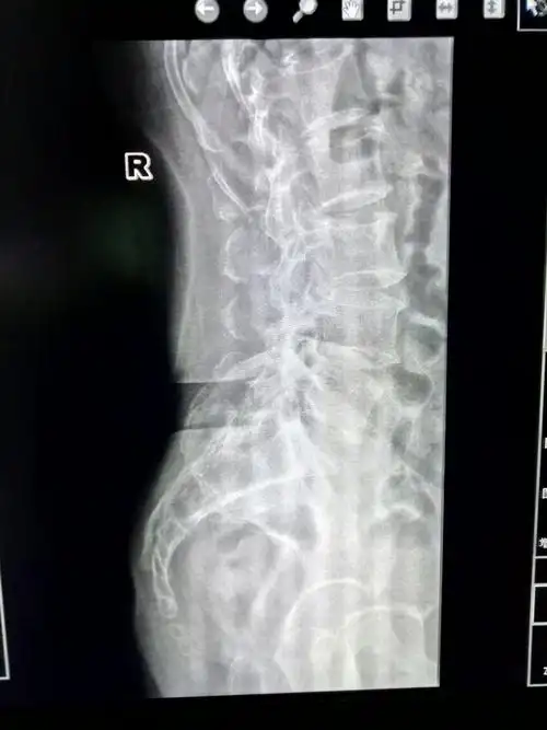 (笑哭)原来以为脊椎是一条弧线弯下去,没想到尾椎骨那里是这样长的