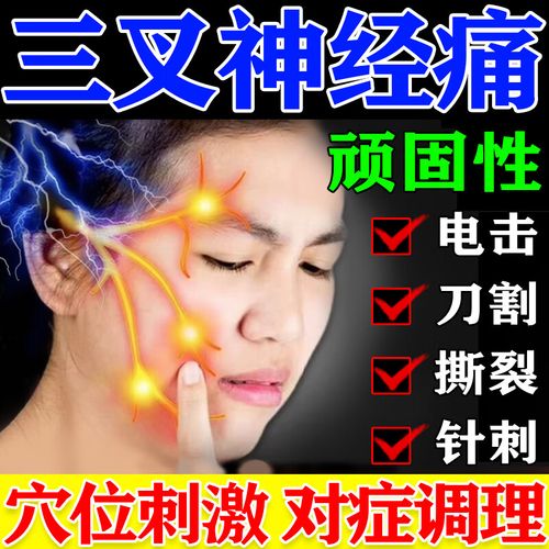治三叉神经痛药】头痛药半边脸疼痛面部神经性肌肉痛反复疼痛撕裂灼烧