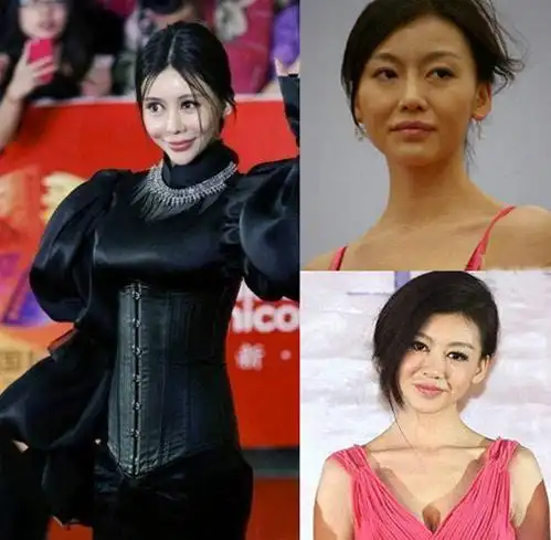 巩新亮整容前后照片