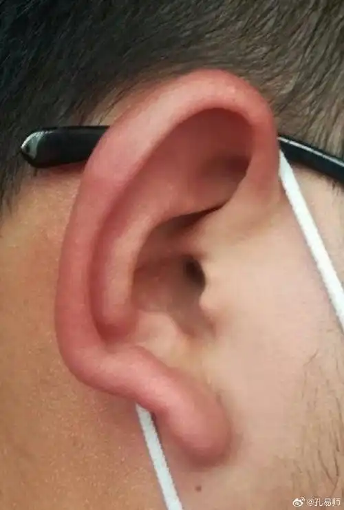 龙朝口耳,福禄很多,做事容易得机遇,被照顾!